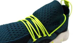 Reebok DMX FUSION MS "mita sneakers"　GRN/N.YEL/BLK/O.WHT7